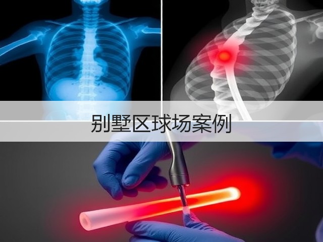 别墅区球场案例(图3)